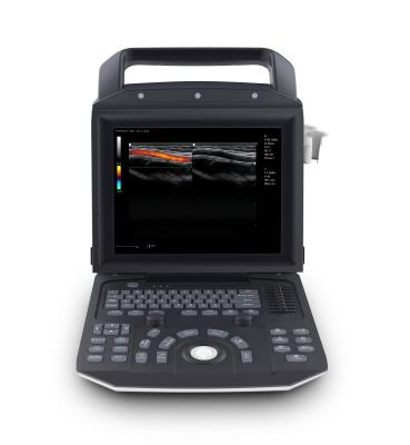 China Factory Direct Selling Handheld Metal Color Doppler With Original Manufacturer Qincare-Q5 Convex Probe Cardiac Ultrasound for sale