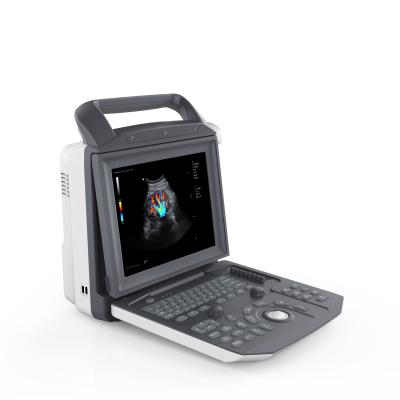 China Portable Color Doppler Qincare-Q5 Echo Ultrasound Metal for sale