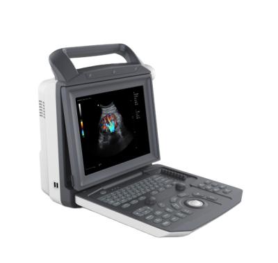 China Portable Metal Ultrasound Color Doppler Qincare-Q5 Cardiac Ultrasound for sale