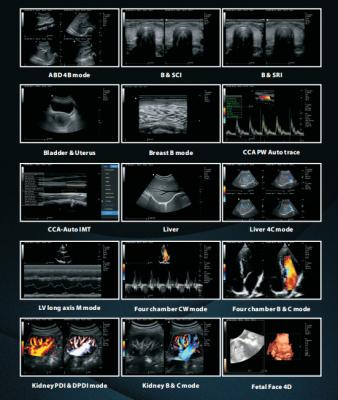 China Clinic Hospital Low Price Portable Color Ultrasound Equipment With Liner Probe Trolley for sale