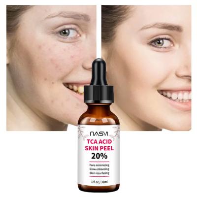 China Anti-puffiness in 20% SKIN ACID TRICHLOROACETIC ACID TEA LEAVES Vitamin C Glow Minimizing Enhancing Skin Care Serum Common Pore Resurfacing Facial Serum for sale