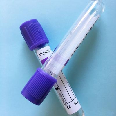 China 2ml PET Medical Disposable Purple Blood Vessel Lid Purple Cap EDTAK2 Medical Disposable Blood Test Tube Purple Cap Anticoagulant Collecting Tube for sale