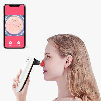 China Acne Treatment Face Beauty Equipment Mini Facial Blackhead Remover Vacuum Camera Pore Remover for sale