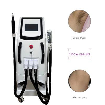 China Pigment Removal Multifunction 3 in 1 NG Yag Laser RF OPT IPL SHR Permanent Laser Hair Removal Machine for sale