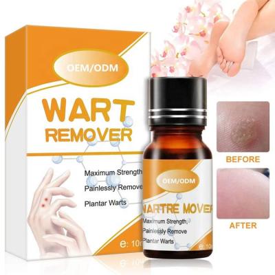 China Peel Revitalizer Private Label 100% Natural Foot Hand Callus Wart Remover Liquid Essence for sale