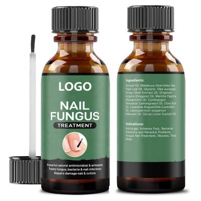 China Repair OEM Finger and Toenail Fungus Treatment, Treatment Athlete's Foot and Antiseptic Infected Toe Nail Fungus Treatment for sale