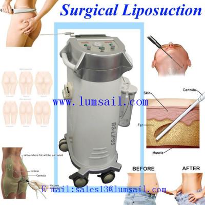 China Vibrating Power Assisted Liposuction Function BS-LIPS5 PAL Surgical Liposuction NEW - Power Assisted Liposuction For Plastic Surgery Center for sale