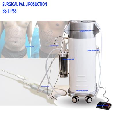 China New Generation Metal Slimming Va Ser Liposuction Machine Liposuction After Surgical Tummy Tuck Liposuction for sale