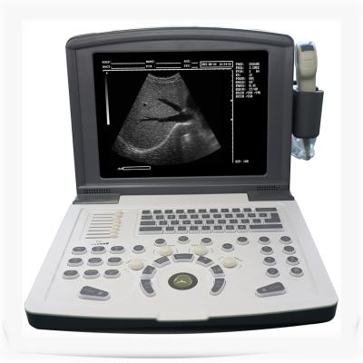 China Portable Cheap Black White Metal Ultrasound Scanner Machine With Probe for sale