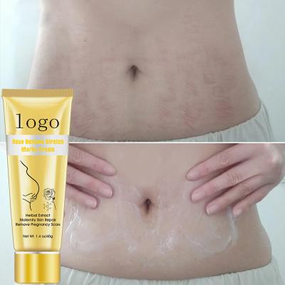 China Skin Revitalizer OEM ODM Private Label Pregnancy Stretch Mark Removal Cream Scar Stretch Marks Removal Gel For Women for sale