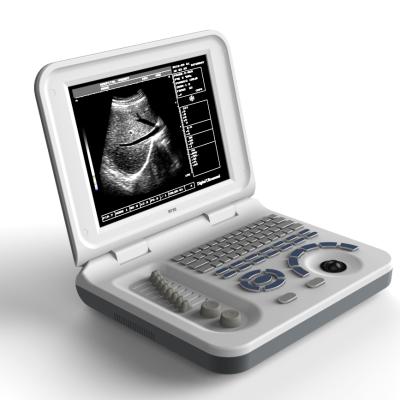 China Custom Logo ABS Logo Ultrasound Scanner Notebook Machine Hospital Diagnostic System S50A Medical Portable Ultrasound Scanner for sale