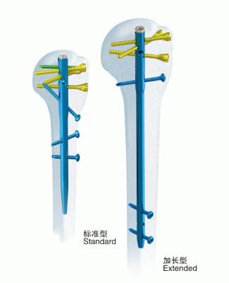 China Chirurgischer Orthopädie-anatomischer Humerus-Ineinander greifennagel zu verkaufen