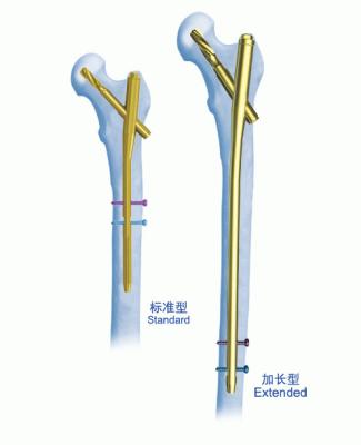 China Clavo que entrelaza de la fijación gamma del clavo del CE de PFNA en venta