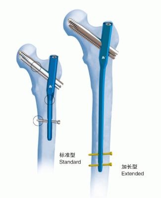 China Orthopädie-Titangamma-Ineinander greifennagelⅣ PFN zu verkaufen