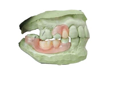 China Flexible Denture Base Resin For Partially Edentulous Restoration Stable And Comfortable for sale