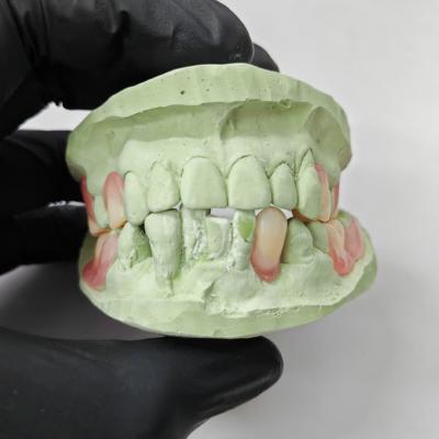 China Resina termoplástica de alta precisão, resina de base de dentadura parcial flexível à venda