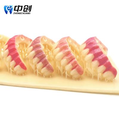 China Gum Shade Kit-4Piece Set Achieve Natural Restoration Effect with Good Gloss Retention for sale