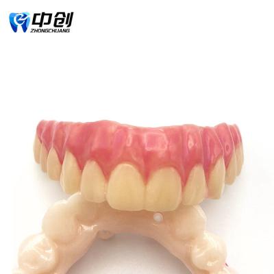 China Highly Radiopaque Pink Opaque 4 Color Aesthetic Resin for Professional Natural Restoration for sale