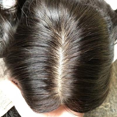 China European Virgin Injection Skin Injection Straight Wholesale Silk Toppers Human Hair Cuticle Aligned Hairpiece Natural Full Cover Hairpiece for sale