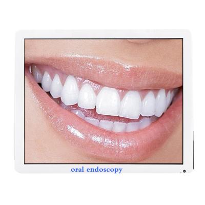 China Metal 17 Inch Screen Metal Five Megapixels Teeth Whitening Dental Intraoral Endoscope Computer Camera for sale