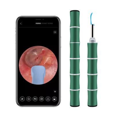 China Viable Tuya App Adults Kids Pampers Otoscope Smart Ear Ear Cleaner Product Ear Cleaning Cleaner for sale