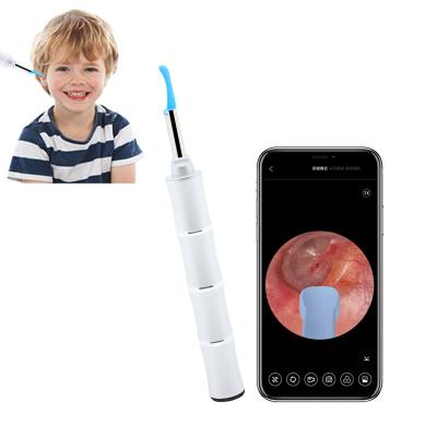 China Viable Visual Digital App Earwax Remover Tuya Ear Wax Remover Camera Pet Ear Cleaning Electric Pet Ear Cleaning for sale