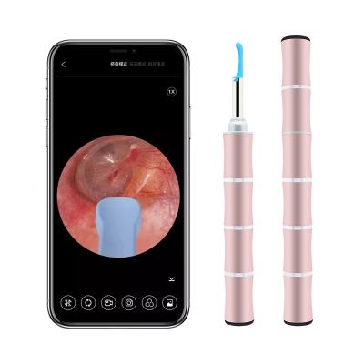 China Wireless Smart Earwax Removal Kit Wifi Control App Baby Ear Harvester 45 Minutes Children Rechargeable Earwax Remover Earwax for sale