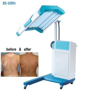 중국 Phototherapy 처리 UVB 빛 치료 기계, UVB 좁은 밴드 가벼운 치료 판매용