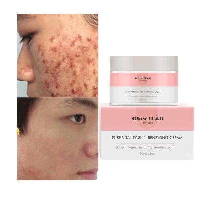 China Best Custom Revitalizer Cantik Skin Logo Repair Cream Facial Woman Facial Care Creams For Dark Spots In China for sale