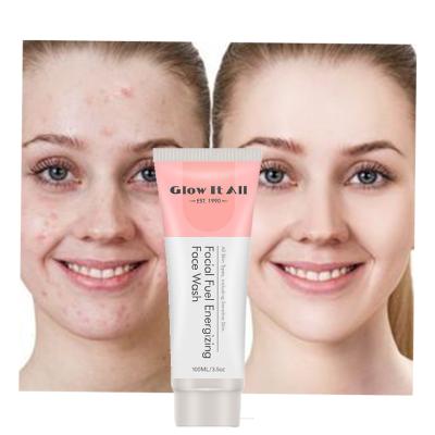 China Wholesale Acne Treatment Low Price Acne Fighting Organic Facial Cleanser Exfoliating Gel Wash Cleansing Sample for sale