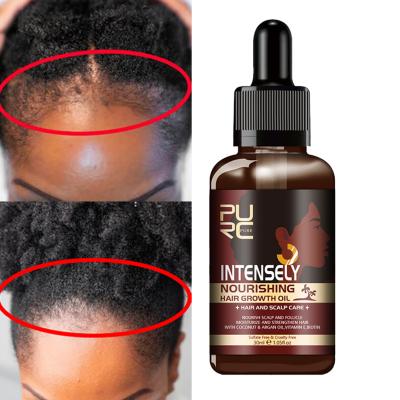 China Natural African Growth Oil Curly Hair Loss Prevention Private Label Women Organic Scalp Care Anti Loss Hair Treatment Biotin Hair Oil Serum for sale