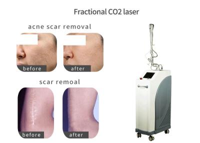 China Vertical Stretch Mark Removal Laser Machine , Laser Skin Care Machine With Air Cooling for sale