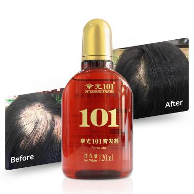 China Professional Alopecia Areata Treatment Alopecia Areata Hair Loss Treatment Hair Growth Serum Tonic for sale