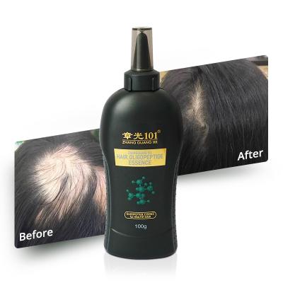 China Wholesale Daily Men's Daily Hair Care Treatment Hair Loss Fast Hair Growth Oil for sale