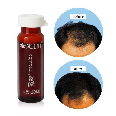 China OEM Daily Organic Scalp Men Hair Tonic Hair Care Growth Nourishing Serum for sale