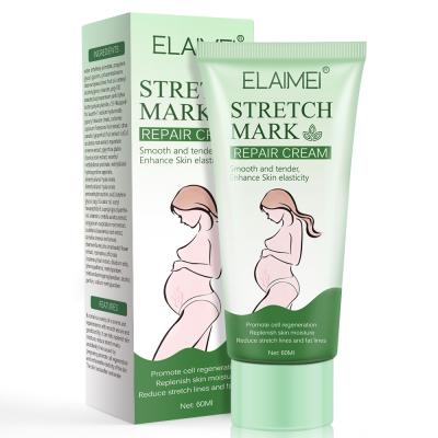 China Skin Revitalizer Private Label Stretch Mark Remover Cream Shea Butter Women Stretch Mark Removal Cream for sale