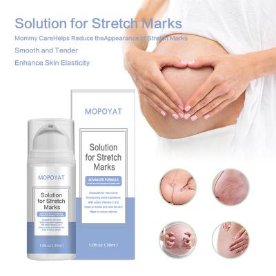 China Skin Revitalizer best quality products anti stretch mark creamanti stretch mark cream stretch mark removal gel for sale