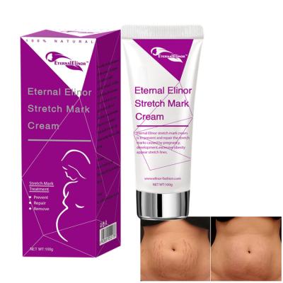 China Skin Revitalizer Private Label Your Own Mark Stretch Mark Removal Cream OEM Scar Removal Cream Prevent Stretch Marks for sale