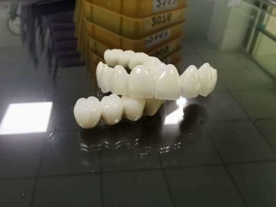 China Non Precious PFM Crown Supreme Metal Crowns And Dentures for sale