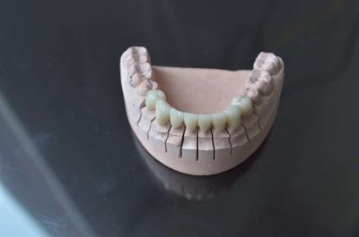 China Layered Permanent Dental Implants Zirconia Implants OEM for sale