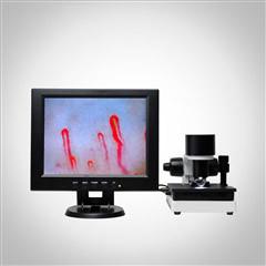 China Microscopio clínico de la microcirculación del análisis de la sangre de la máquina del analizador de la salud de la exhibición del LCD en venta