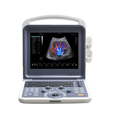 China FK2 Scan 6 Tongues Support Portable Color Doppler Ultrasound Scanner for sale