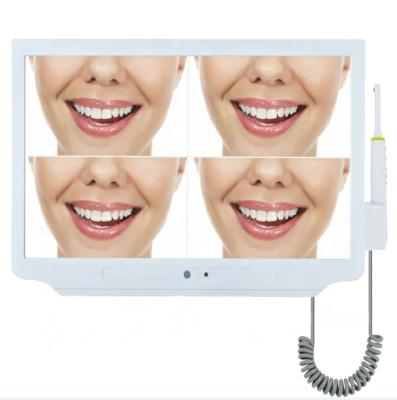 China Plastic Monitor 17inch Dental Endoscope Integrated Intraoral Camera With U Disk + WIFI 8 Mega Pixel for sale