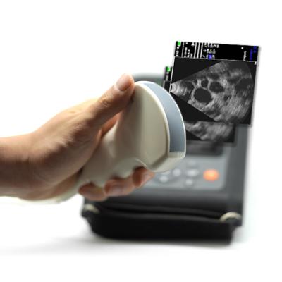 China Price High Resolution Portable Ultrasound Machine Echocardiography Pregnancy Scanner Vet for sale