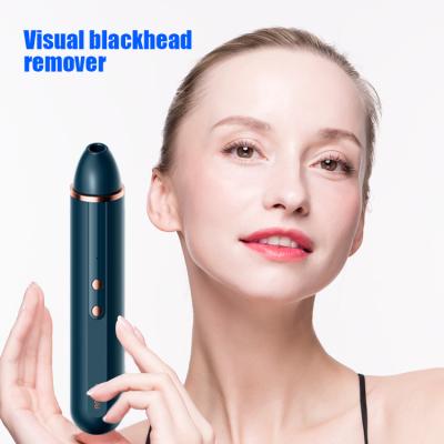 China 2021 New Modern Acne Treatment New Arrival Design Batteries Powering Vacuum Equipment Blackhead And Pimple Remover Cleansing Face for sale