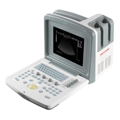 China NEW Ultimate Compact and Lightweight Design for Instant Transfer SINOHERO S880Prime- CHECK Obstetric Ultrasound Color Doppler Machine China Ultrasound Device Transducer Price for sale