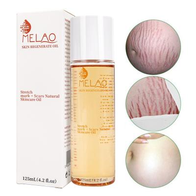 China Wholesale Skin Revitalizer OEM/ODM MELAO Revitalizer OEM/ODM Regenerated Stretch Mark Oil Natural Organic Skincare Oil Scar Repair for sale