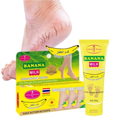 China Peeling Exfoliating Moisturizing Whitening Working Hands Healthy Feet Peel Repair Foot Cream Exfoliator Moisturizer To Smooth Softening Dry Feet Heels Peel Lotion for sale