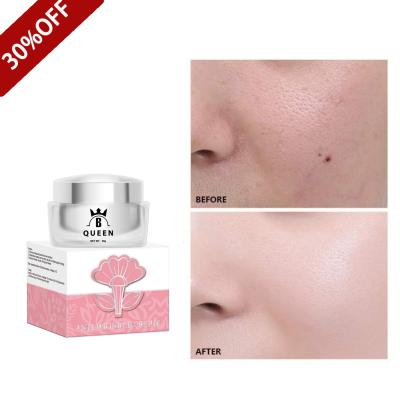 China Dark circles moisturizing face cream anti aging and wrinkle facial cream for sale