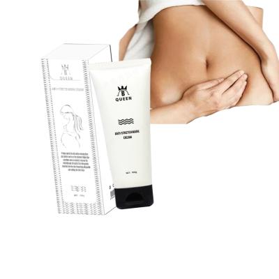 China Perfect Moisturizer Stretch Mark Reducing Cream For Pregnant Woman Cream For Stretch Marks Removal Cream for sale